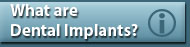 What are Dental Implants