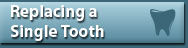 Replacing a Single Tooth